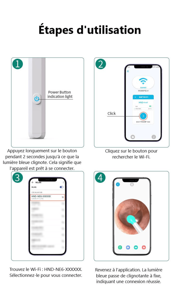 Nettoyeur d'oreille à caméra | Otoscope™