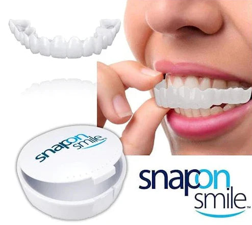 Snap on Smile-Pro : Confort et ajustement parfait