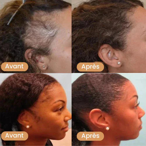 Huile de Batana 100% Pure