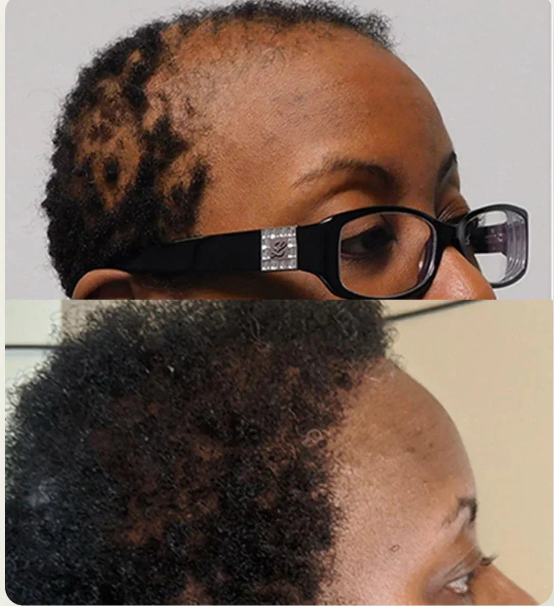 Huile de Batana 100% Pure