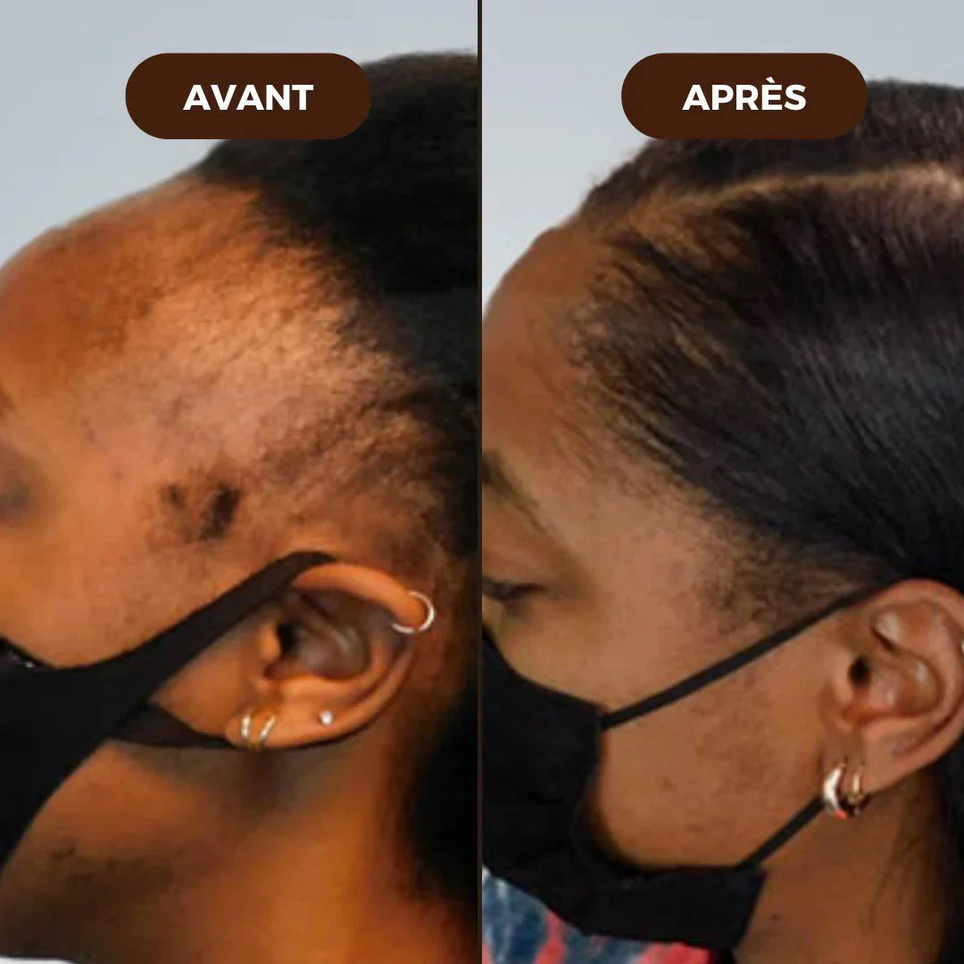 Huile de Batana 100% Pure