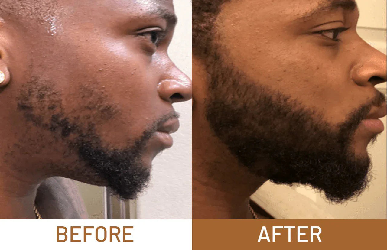 Huile de Batana 100% Pure