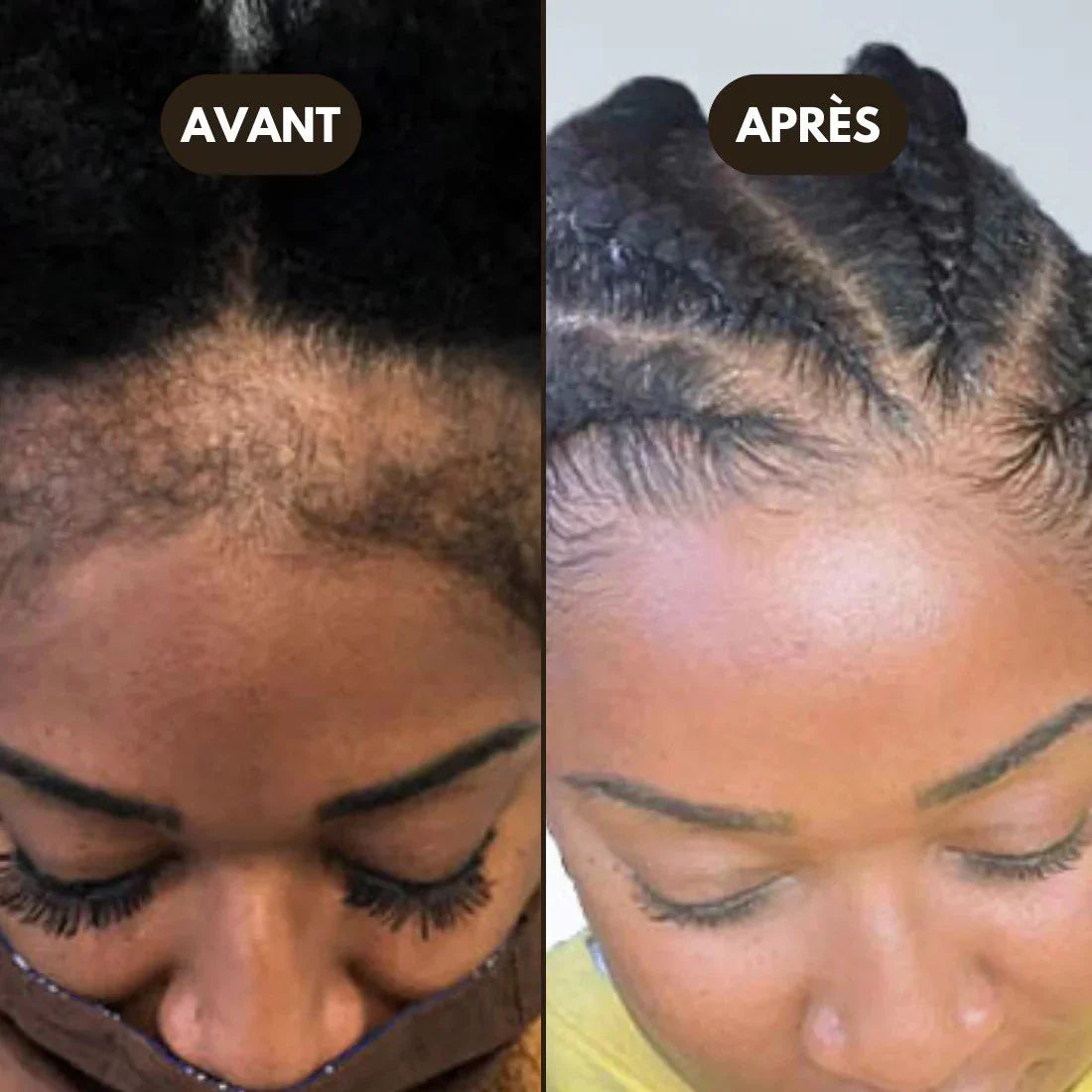 Huile de Batana 100% Pure